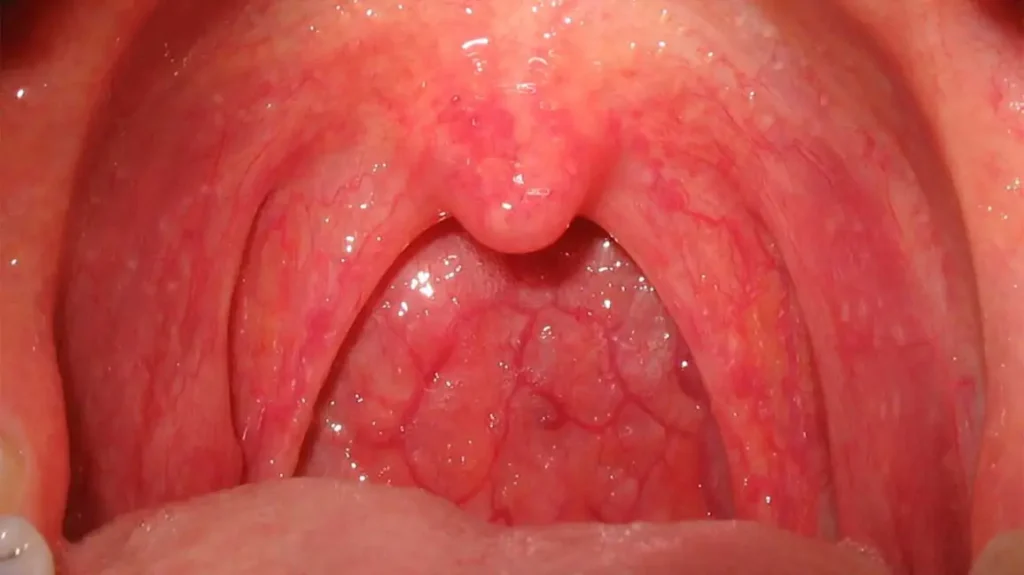 healthy throat image